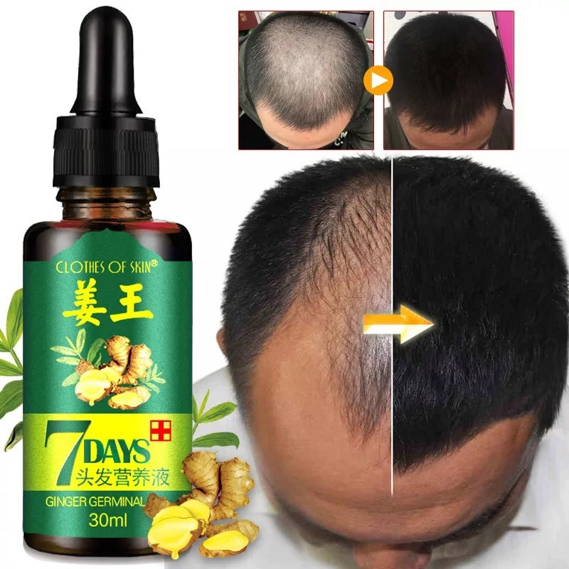 Minyak Jahe Penumbuh Menebalkan Rambut Tanpa Bilas 30ML 蝦皮購物