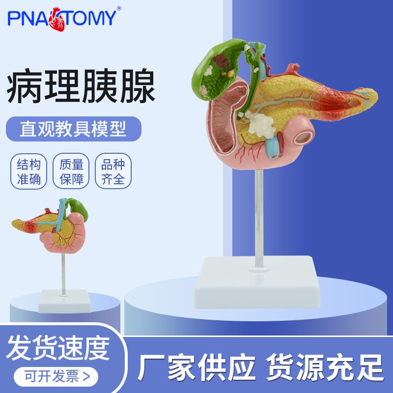 繁星優選胰腺模型十二指腸膽囊病理解剖教具結石 內臟器官 消化系統展示用 | 蝦皮購物