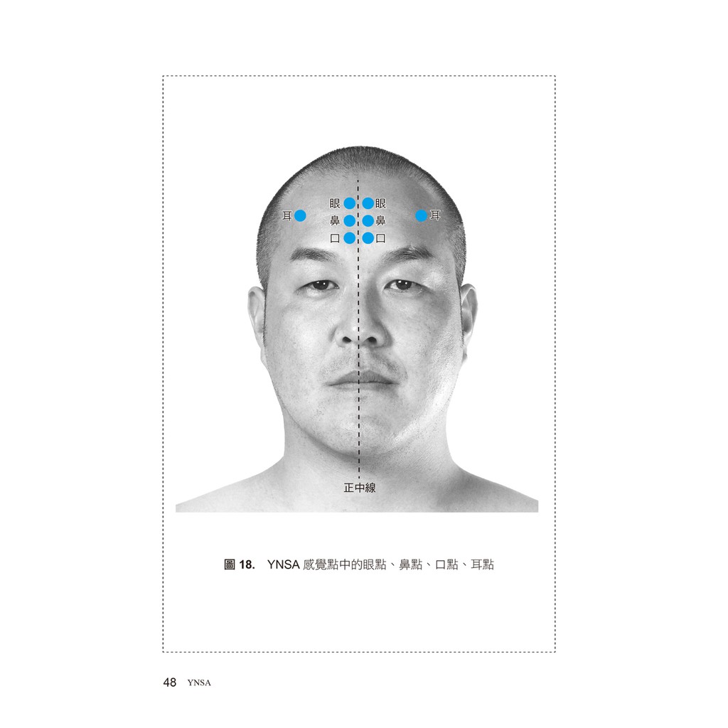 YNSA山元式新頭針療法：真人圖解刺激點施針教科書！ | 蝦皮購物