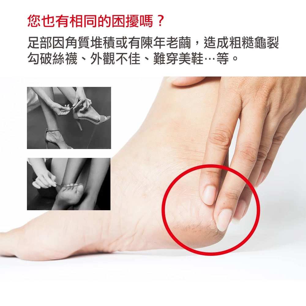 電動磨腳皮機推薦