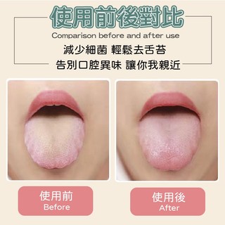 雙效舌苔刷 舌苔牙刷 舌苔 舌苔清潔器 舌苔刷 刮舌苔 舌苔清潔 刮舌棒 刮舌器 清舌苔 刮舌板 舌苔清潔刷 口腔清潔棒 | 蝦皮購物