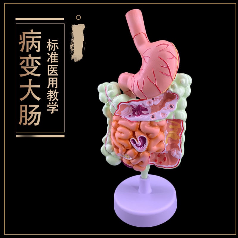 人體消化系統解剖模型 大腸模型 直腸十二指腸 內臟腸胃解剖構造模型醫學教具 拆卸演示工具 教師道具 教學配件 器官解剖模 | 蝦皮購物