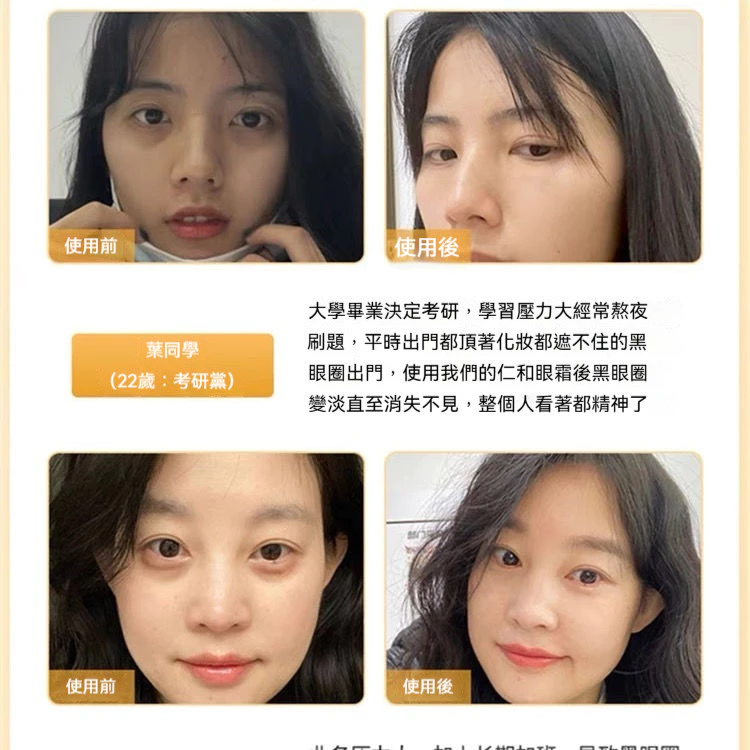 泊泉雅眼霜