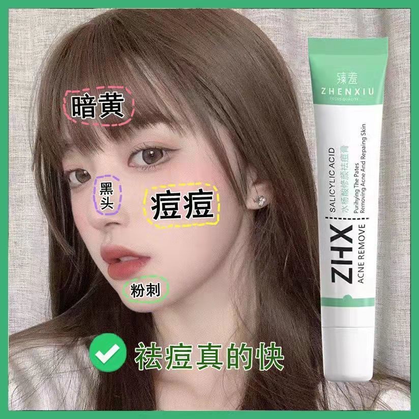 水楊酸去痘膏 痘印 痘疤 青春痘 粉刺 淡化痘印 黑頭 | 蝦皮購物