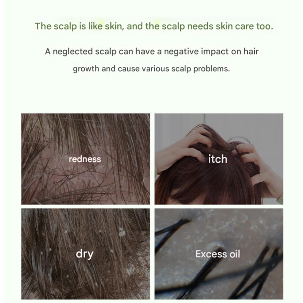 Steam Base Tea Tree scalp Healing Tonic 100 毫升流行提亮水頭皮防脫髮 max | 蝦皮購物