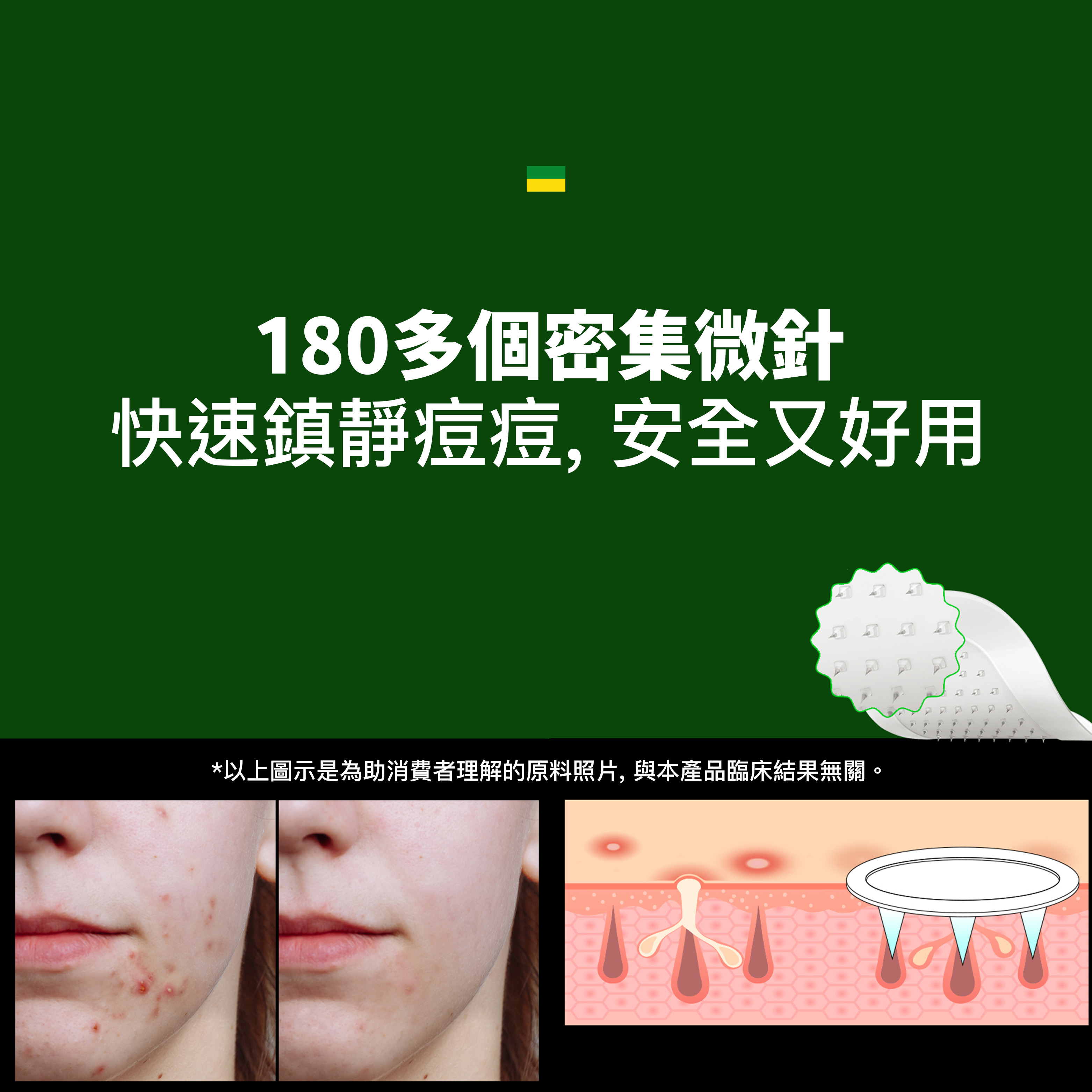 TROUBLESS 多重茶樹 Micro Point Patch | 蝦皮購物