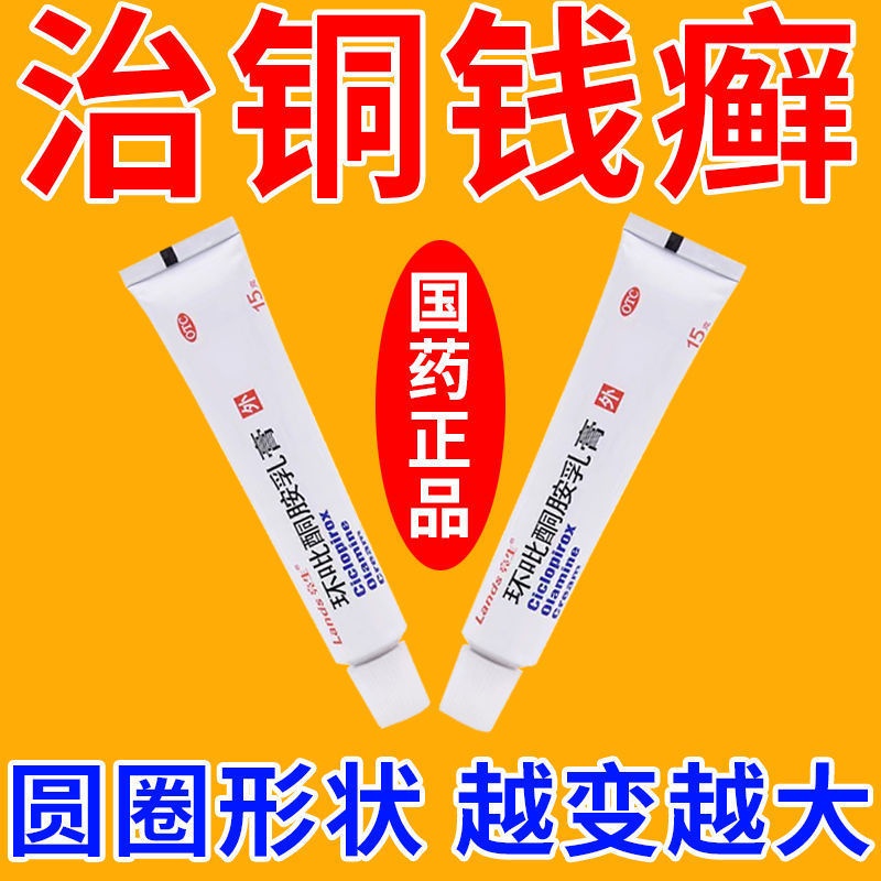 【治銅錢癬】銅錢癬皮膚癬花 癬頭皮癬體股癬手足癬瘙癢紅 脫皮 正品 | 蝦皮購物
