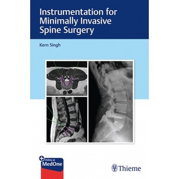 Instrumentation for Minimally Invasive Spine Surgery /Kern Singh 神經外科 ...