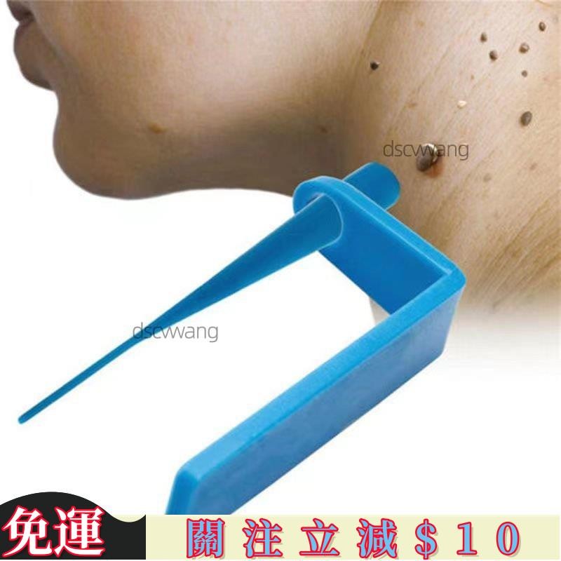 HM優選 抖音衕款祛脖子長小肉粒猴子疙瘩腋下痦子除皮贅神器絲疣工具雙頭 | 蝦皮購物