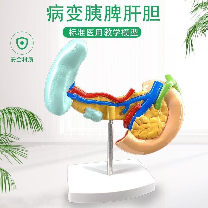 小百合模病變胰脾肝膽十二指腸模型病理標本胰脾肝膽人體器官解剖教學模型模型展示模型 | 蝦皮購物
