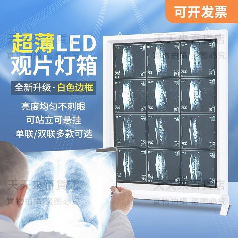 優*觀片燈 ct超薄看片燈 x光閱片燈 讀單聯科雙聯科led觀片 燈箱 價目表 壓克力燈板 可旋鈕調光x光燈單聯雙聯 | 蝦皮購物