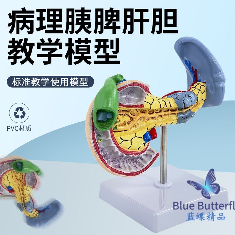 包郵!仿真病變胰脾肝膽十二指腸模型病理胰脾肝膽人體器官解剖教學人體模型 教学 模型 穴位 關節骨架 模具 | 蝦皮購物