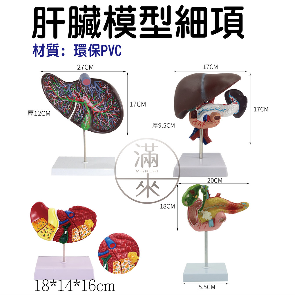 可開發票 肝臟模型 肝臟解剖模型 肝膽胰脾十二指腸模型 病變肝膽胰模型 脂肪肝 肝梗化 肝臟病理模型 客滿來ARXL | 蝦皮購物