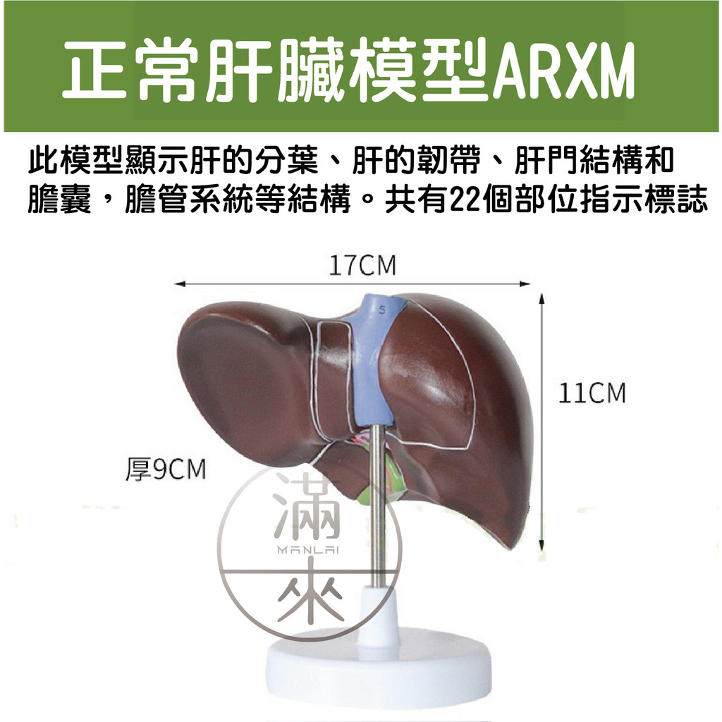 可開發票 肝臟模型 肝臟解剖模型 肝膽胰脾十二指腸模型 病變肝膽胰模型 脂肪肝 肝梗化 肝臟病理模型 客滿來ARXL | 蝦皮購物
