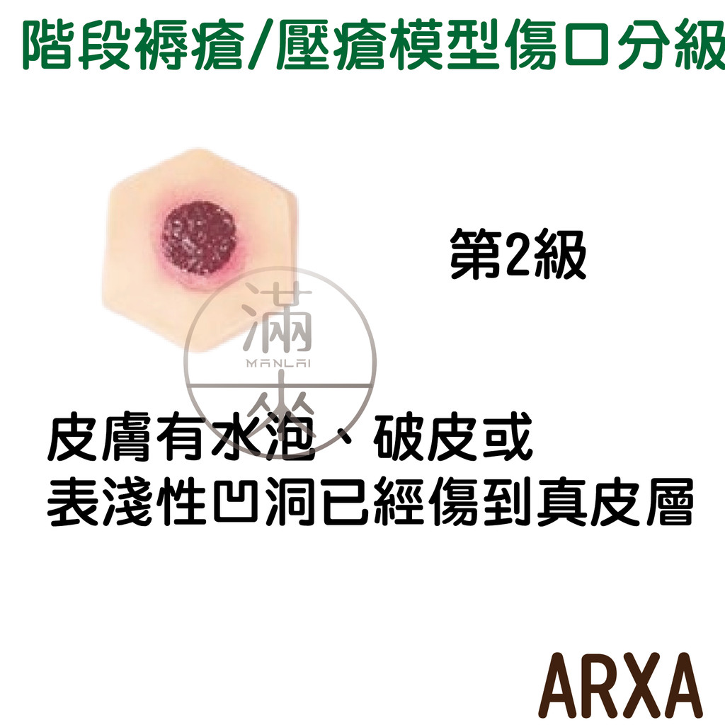 可開發票 4階段褥瘡 壓瘡 護理模型 褥瘡壓瘡訓練教具 臀部褥瘡模型醫學教學用模型 壓瘡模型 傷口護理 客滿來ARXA | 蝦皮購物