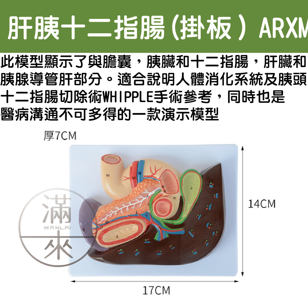可開發票 肝臟模型 肝臟解剖模型 肝膽胰脾十二指腸模型 病變肝膽胰模型 脂肪肝 肝梗化 肝臟病理模型 客滿來ARXL | 蝦皮購物