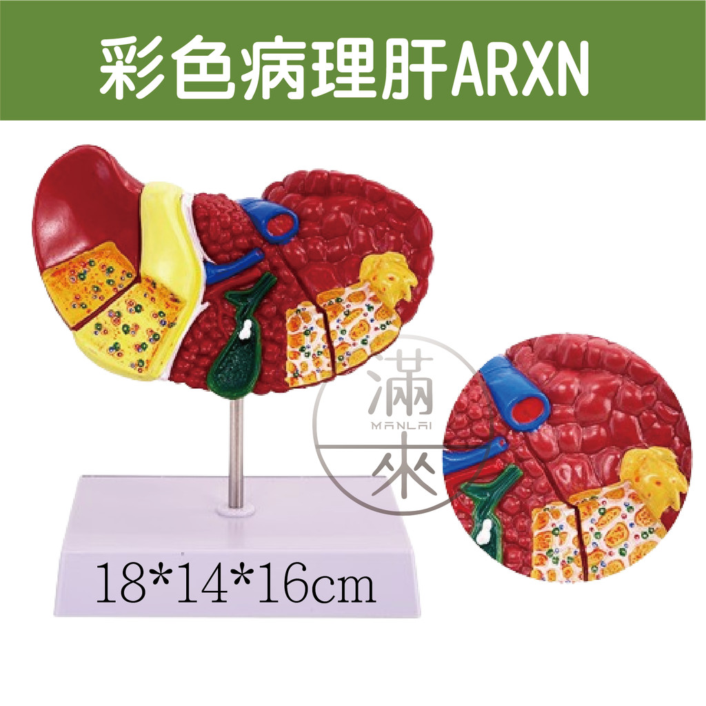 可開發票 肝臟模型 肝臟解剖模型 肝膽胰脾十二指腸模型 病變肝膽胰模型 脂肪肝 肝梗化 肝臟病理模型 客滿來ARXL | 蝦皮購物