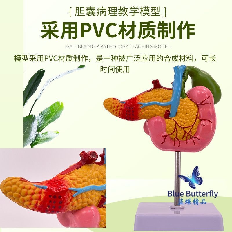 可開發票 醫學科普胰腺十二指腸膽囊病理模型 膽結石肝膽科仿真 人體模型 器官模型 敎學人體模型 人體解剖模型 | 蝦皮購物