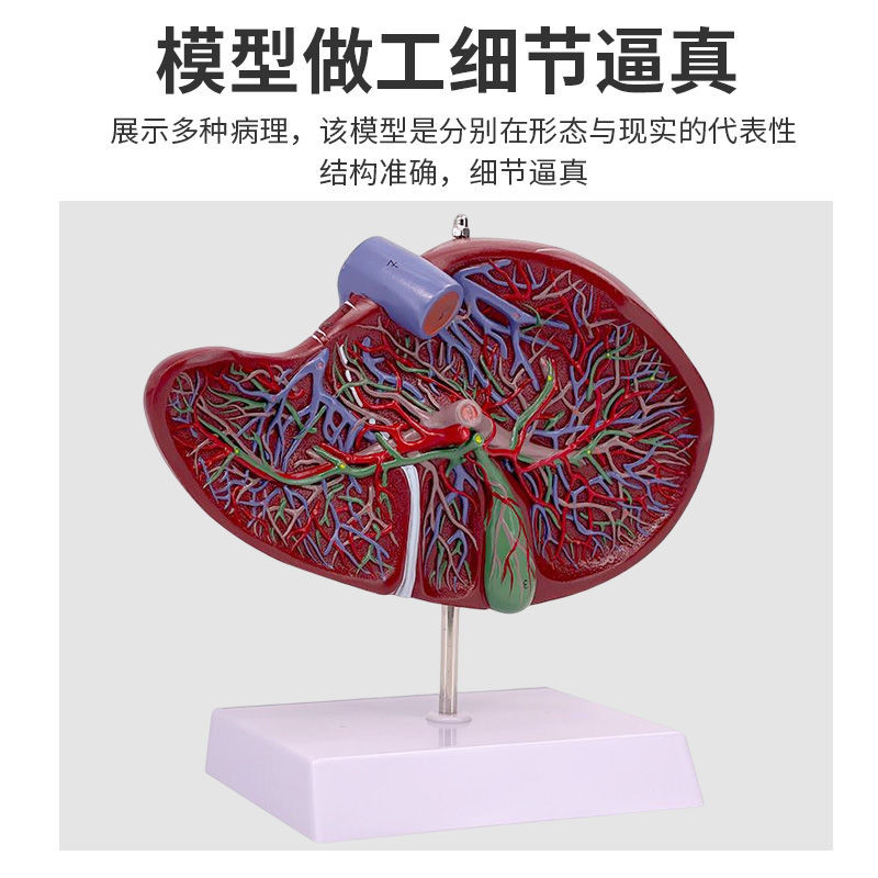 可開發票人體肝臟模型肝解剖模型肝膽胰脾十二指腸病變肝膽胰膽囊消化內臟 人體模型 器官模型 敎學人體模型 人體解剖模型 | 蝦皮購物