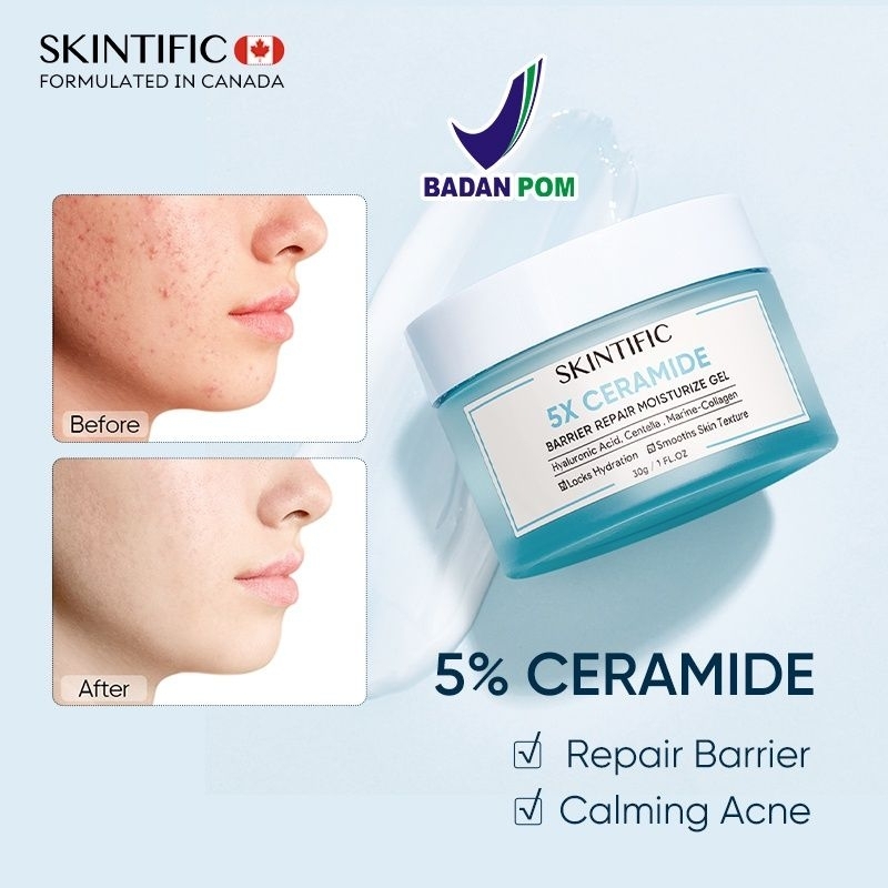 Skintific 5x Ceramide Barrier Moisture Gel Msh Niacinamide 蝦皮購物 5644