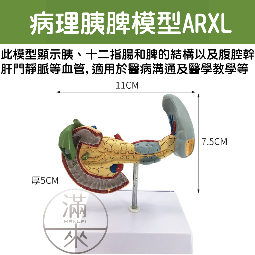可開發票 肝臟模型 肝臟解剖模型 肝膽胰脾十二指腸模型 病變肝膽胰模型 脂肪肝 肝梗化 肝臟病理模型 客滿來ARXL | 蝦皮購物