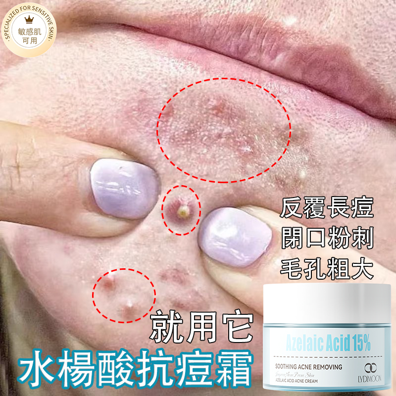 水楊酸抗痘凝膠（自然萃取溫和款）