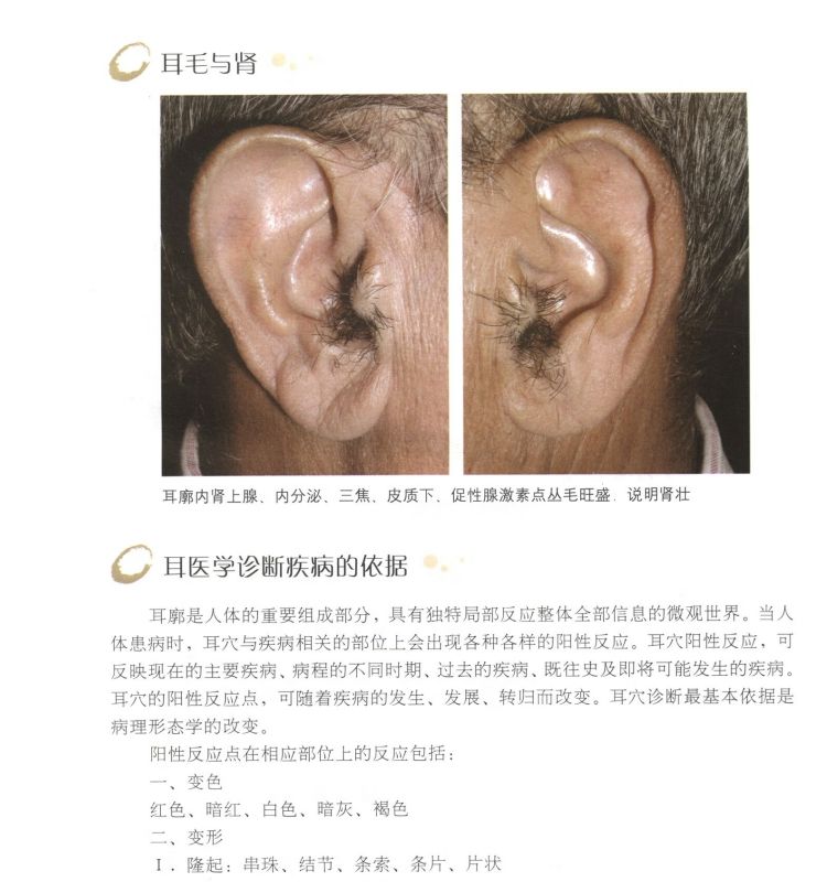 全店促銷 耳穴 黃麗春 耳穴治療學 耳穴診斷學 耳醫學治療 耳穴诊断彩色图鉴 耳穴治療學第二版 耳療 耳穴診療 | 蝦皮購物