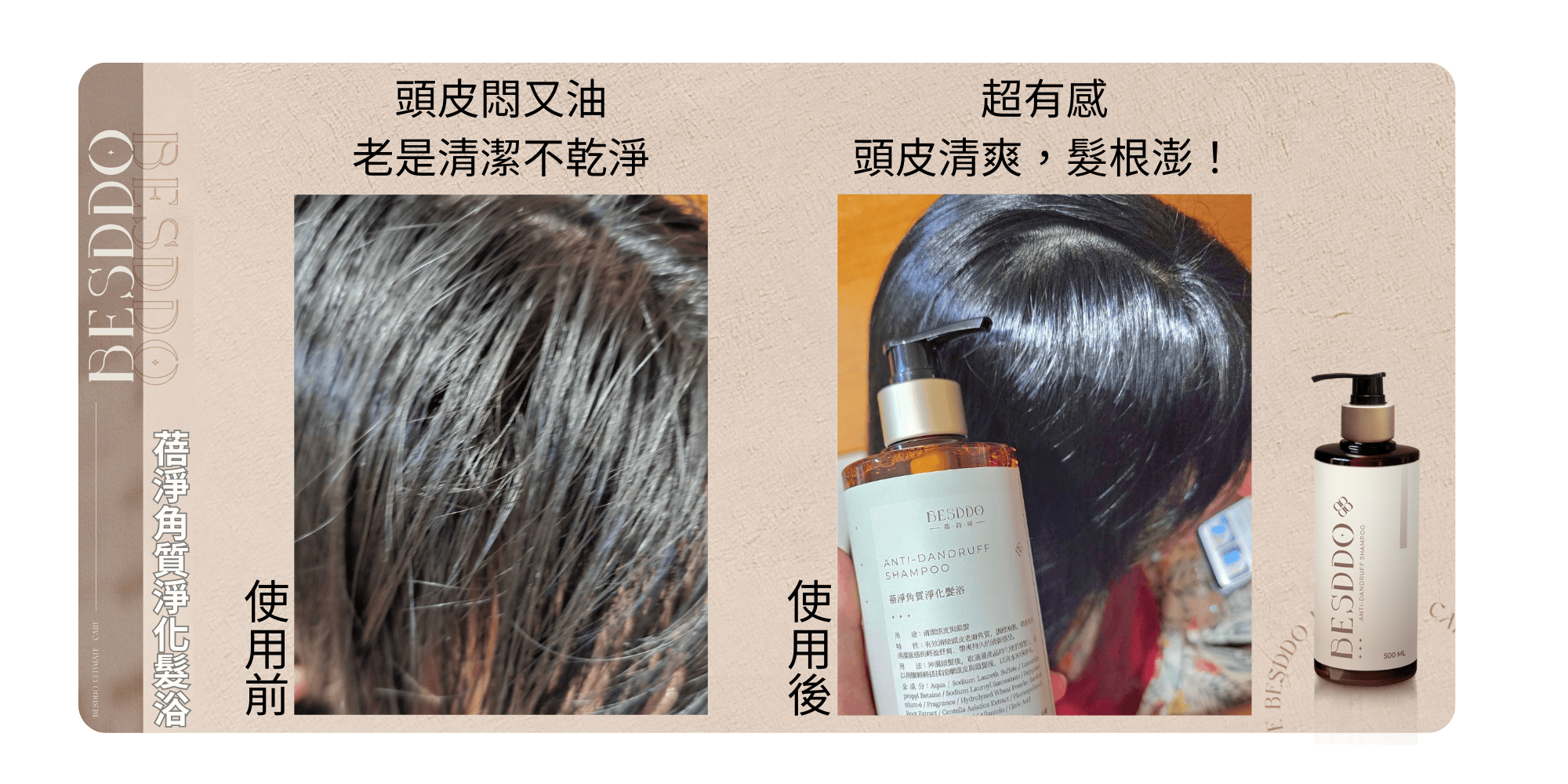 頭皮悶又油，超有感，老是清潔不乾淨，頭皮清爽,髮根澎!一番詩一，蓓淨角質淨化髮浴，途:清潔頭皮與頭髮，二特止性:有效清除須安老廢角質 3000 好，清配後感到輕益舒爽、带来持久的清新感受。以所雄料輕揉按摩流皮與癪聲後，金成分:Aqua / Sodiu