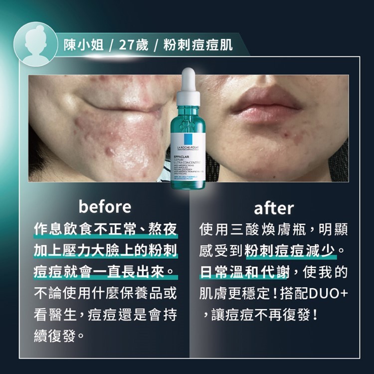如何選擇理膚寶水極效三重酸煥膚精華？誰適合使用？ (6/13)